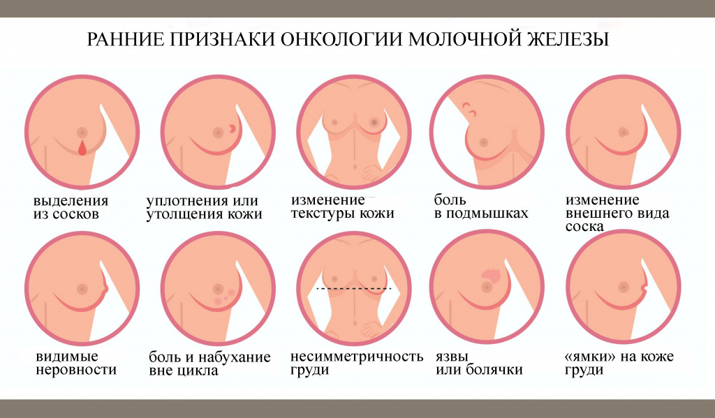 Описание симптомов рак груди